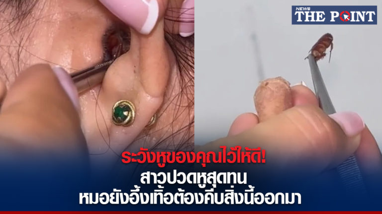 ระวังหูของคุณไว้ให้ดี! สาวปวดหูสุดทน หมอยังอึ้งเทิ้อต้องคีบสิ่งนี้ออกมา